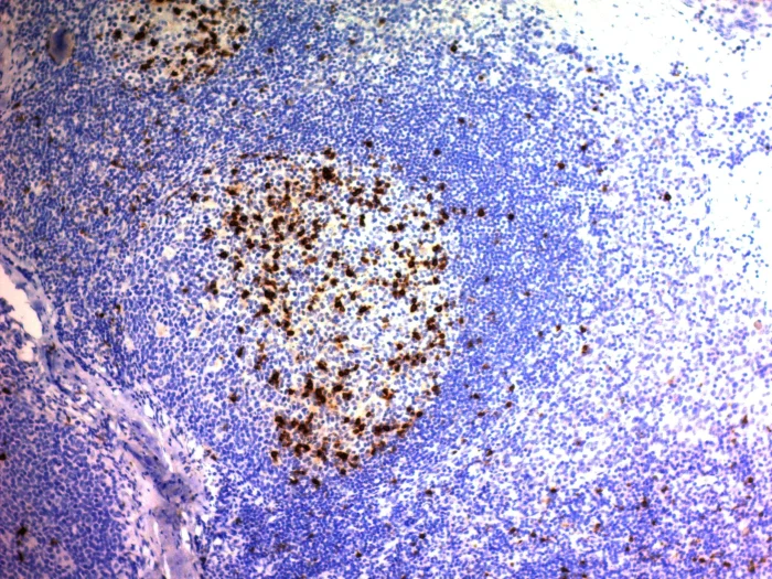 Immunohistochemistry (Formalin/PFA-fixed paraffin-embedded sections) - Anti-CD57 antibody [NK/804] (AB220187)