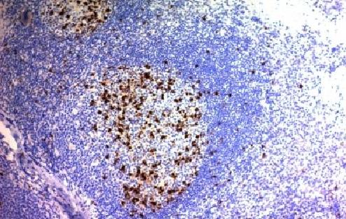 Immunohistochemistry (Formalin/PFA-fixed paraffin-embedded sections) - Anti-CD57 antibody [NK/804] - BSA and Azide free (AB212408)