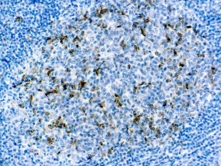 Immunohistochemistry (Formalin/PFA-fixed paraffin-embedded sections) - Anti-CD57 antibody [NK1], prediluted (AB82749)