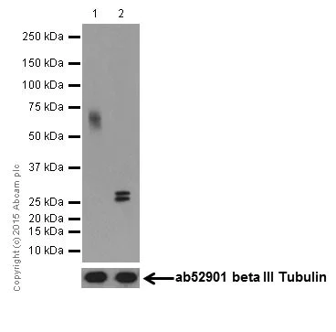 Western blot - Anti-CD58 antibody [EP15041] (AB196648)
