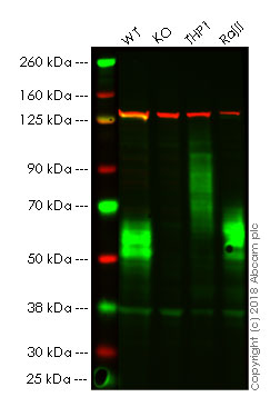 Western blot - Anti-CD58 antibody [EP15041] (AB196648), expandable thumbnail