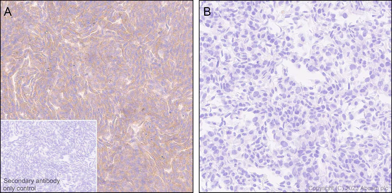 Immunohistochemistry (Formalin/PFA-fixed paraffin-embedded sections) - Anti-CD58 antibody [EPR24012-2] - BSA and Azide free (AB308436)