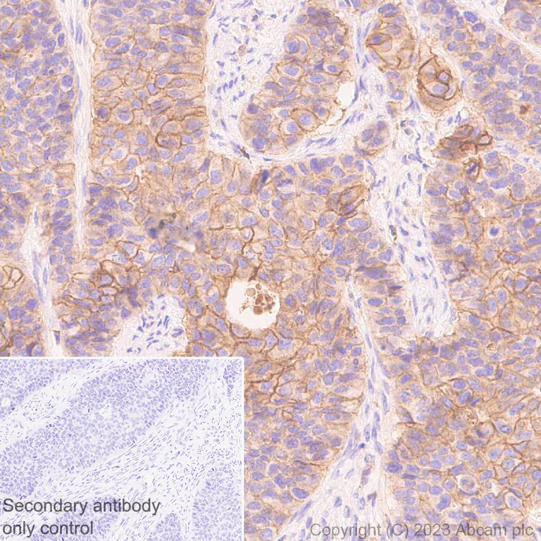 Immunohistochemistry (Formalin/PFA-fixed paraffin-embedded sections) - Anti-CD58 antibody [EPR24012-2] - BSA and Azide free (AB308436)