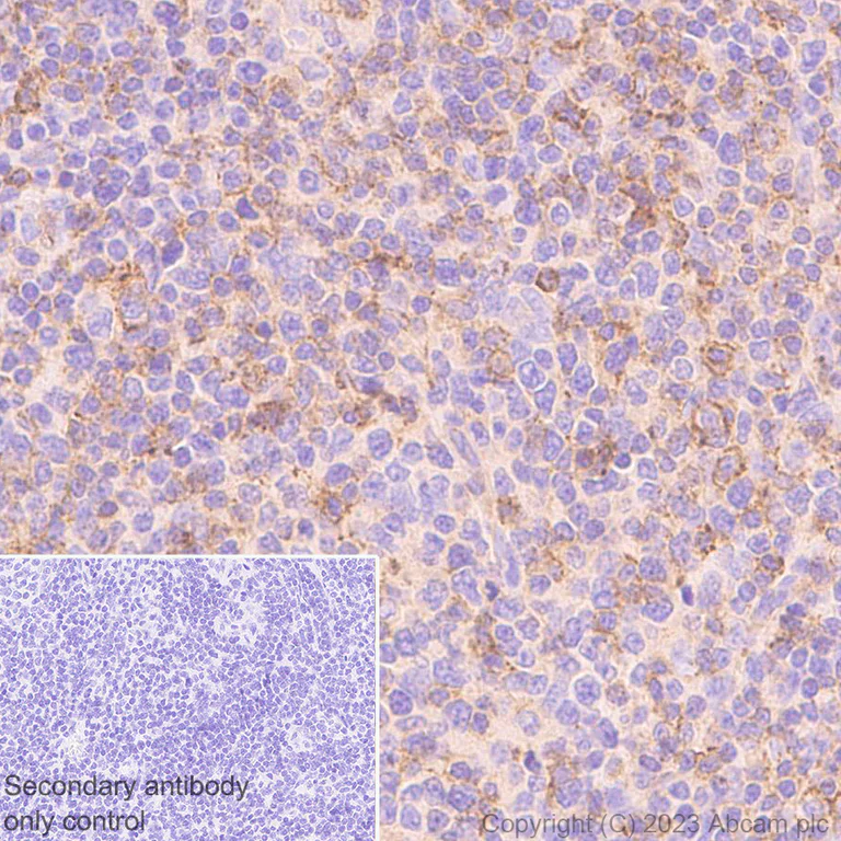 Immunohistochemistry (Formalin/PFA-fixed paraffin-embedded sections) - Anti-CD58 antibody [EPR24012-2] - BSA and Azide free (AB308436)