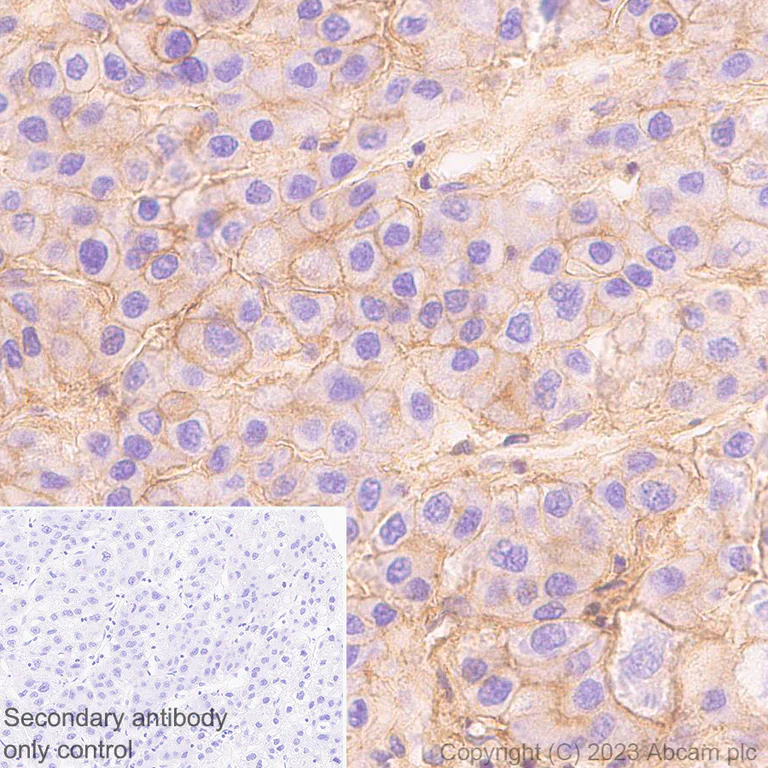 Immunohistochemistry (Formalin/PFA-fixed paraffin-embedded sections) - Anti-CD58 antibody [EPR24012-2] - BSA and Azide free (AB308436)