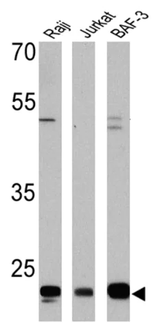 Western blot - Anti-CD58 antibody [TS2/9] (AB171087)