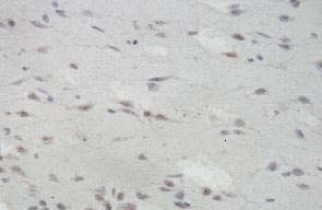 Immunohistochemistry (Formalin/PFA-fixed paraffin-embedded sections) - Anti-CD59 antibody (AB124396), expandable thumbnail