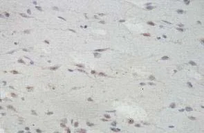Immunohistochemistry (Formalin/PFA-fixed paraffin-embedded sections) - Anti-CD59 antibody (AB124396)