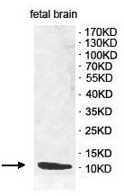 Western blot - Anti-CD59 antibody (AB124396), expandable thumbnail