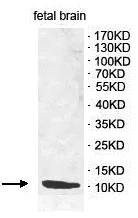 Western blot - Anti-CD59 antibody (AB124396)