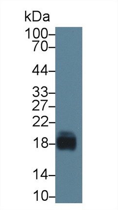Western blot - Anti-CD59 antibody (AB231099), expandable thumbnail
