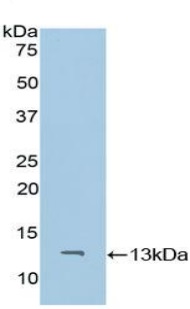 Western blot - Anti-CD59 antibody (AB231099), expandable thumbnail