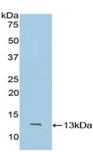 Western blot - Anti-CD59 antibody (AB231099)