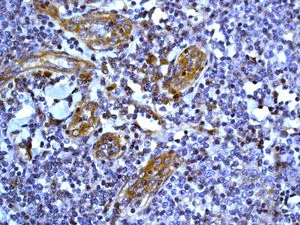 Immunohistochemistry (Formalin/PFA-fixed paraffin-embedded sections) - Anti-CD59 antibody [EPR6425(2)] (AB133707)