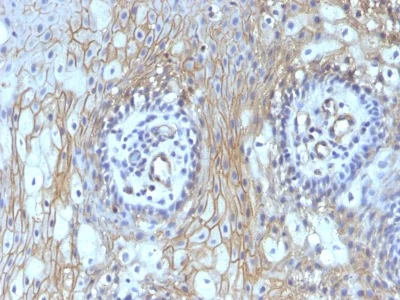 Immunohistochemistry (Formalin/PFA-fixed paraffin-embedded sections) - Anti-CD59 antibody [MACIF/629] (AB234013)