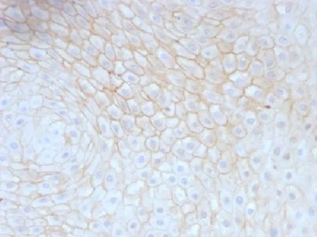Immunohistochemistry (Formalin/PFA-fixed paraffin-embedded sections) - Anti-CD59 antibody [MACIF/629] - BSA and Azide free (AB213087)