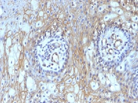 Immunohistochemistry (Formalin/PFA-fixed paraffin-embedded sections) - Anti-CD59 antibody [MACIF/629] - BSA and Azide free (AB213087)