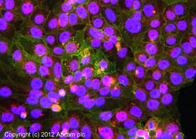 Immunocytochemistry/ Immunofluorescence - Anti-CD59 antibody [MEM-43/5] (AB9183)