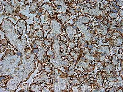 Immunohistochemistry (Formalin/PFA-fixed paraffin-embedded sections) - Anti-CD59 antibody [MEM-43/5] (AB9183)