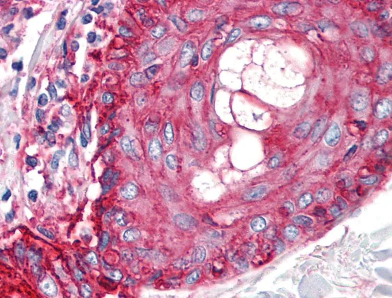 Immunohistochemistry (Formalin/PFA-fixed paraffin-embedded sections) - Anti-CD59 antibody [MEM-43/5] (AB9183)