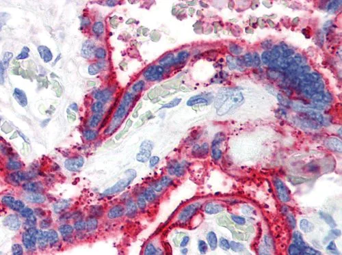 Immunohistochemistry (Formalin/PFA-fixed paraffin-embedded sections) - Anti-CD59 antibody [MEM-43] (AB9182)