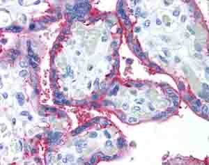 Immunohistochemistry (Formalin/PFA-fixed paraffin-embedded sections) - Anti-CD59 antibody [p282 (H19)] (AB79520), expandable thumbnail