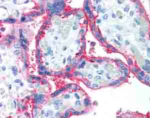 Immunohistochemistry (Formalin/PFA-fixed paraffin-embedded sections) - Anti-CD59 antibody [p282 (H19)] (AB79520)