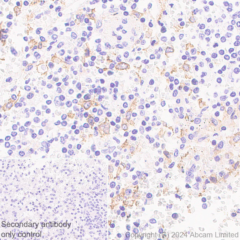 Immunohistochemistry (Formalin/PFA-fixed paraffin-embedded sections) - Anti-CD5L/CT-2 antibody [EPR29363-540] (AB323268)
