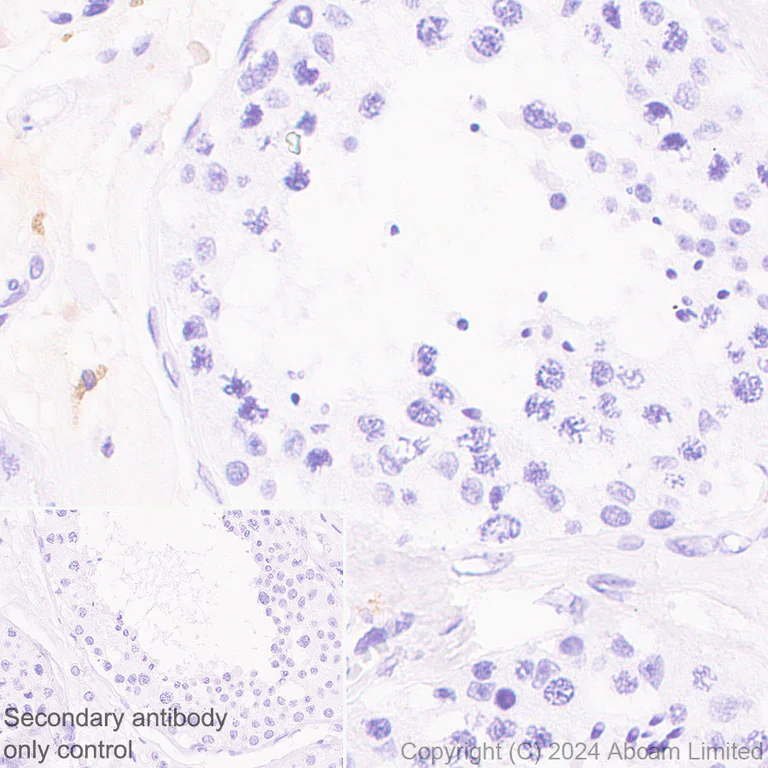 Immunohistochemistry (Formalin/PFA-fixed paraffin-embedded sections) - Anti-CD5L/CT-2 antibody [EPR29363-540] (AB323268)