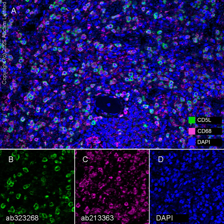 Multiplex immunohistochemistry - Anti-CD5L/CT-2 antibody [EPR29363-540] (AB323268)