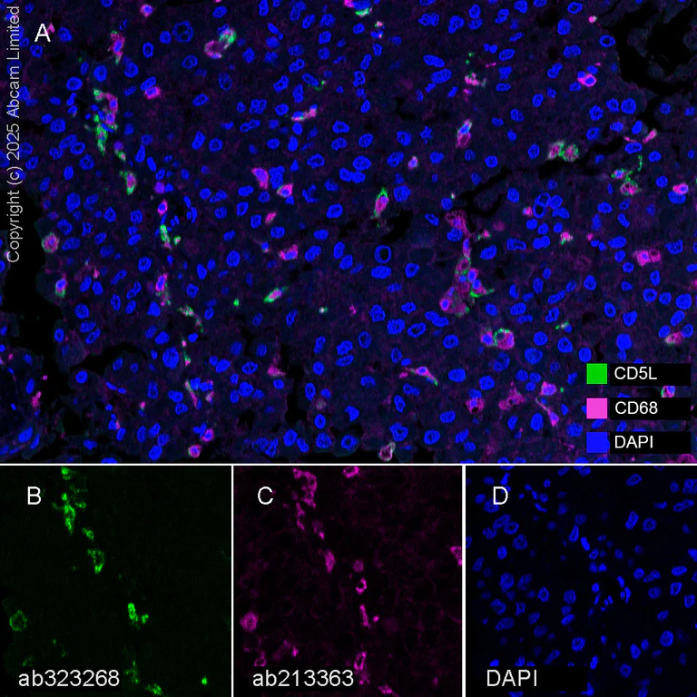 Multiplex immunohistochemistry - Anti-CD5L/CT-2 antibody [EPR29363-540] (AB323268)
