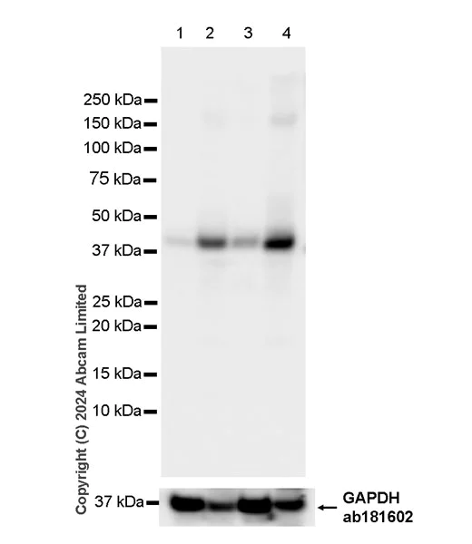 Western blot - Anti-CD5L/CT-2 antibody [EPR29363-540] (AB323268)