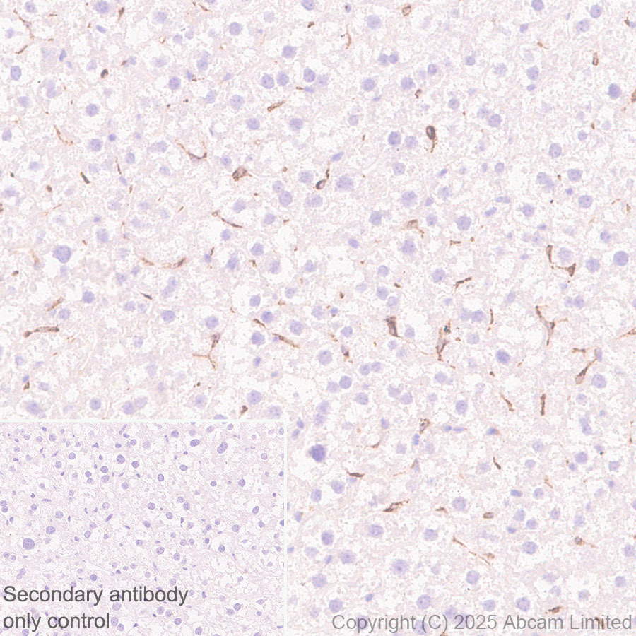 Immunohistochemistry (Formalin/PFA-fixed paraffin-embedded sections) - Anti-CD5L/CT-2 antibody [EPR29364-21] (ab324193), expandable thumbnail
