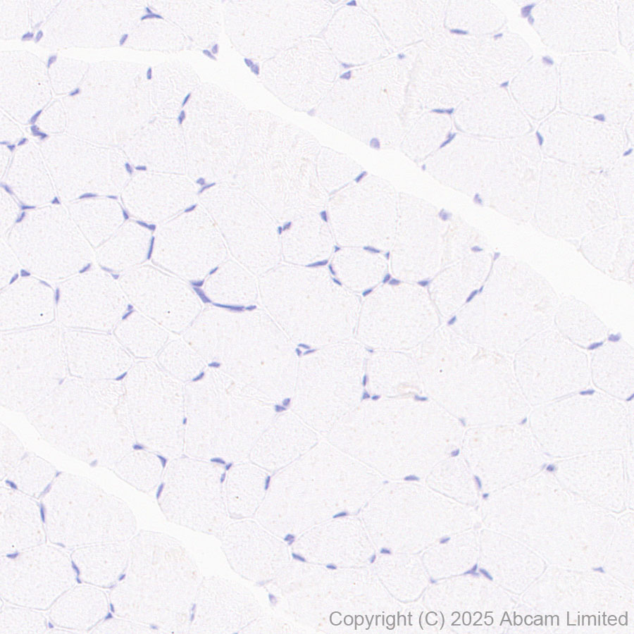 Immunohistochemistry (Formalin/PFA-fixed paraffin-embedded sections) - Anti-CD5L/CT-2 antibody [EPR29364-21] (AB324193), expandable thumbnail