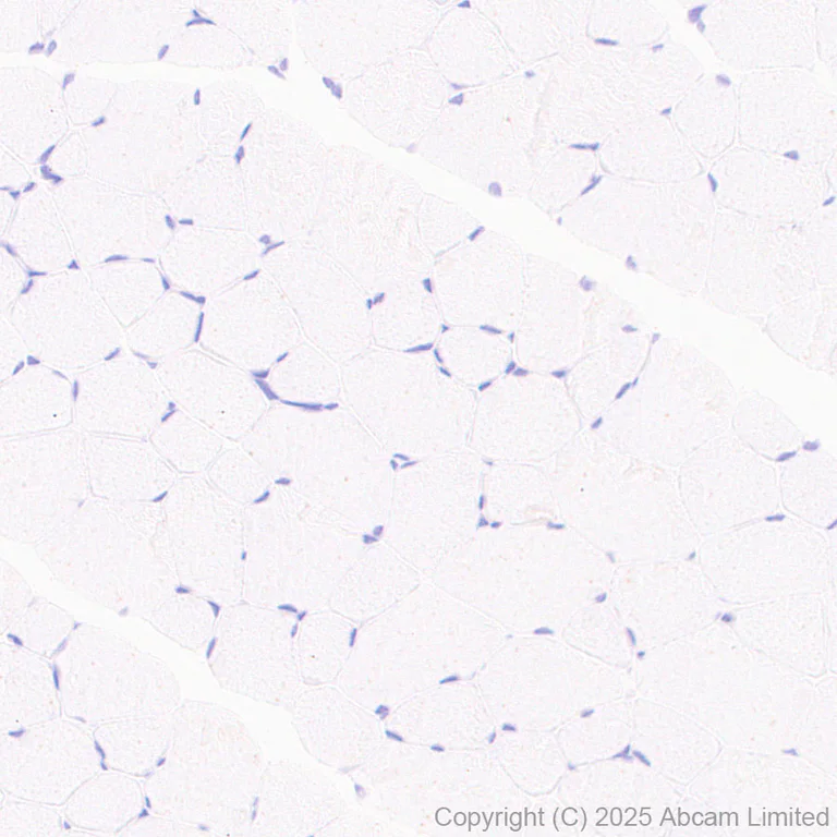 Immunohistochemistry (Formalin/PFA-fixed paraffin-embedded sections) - Anti-CD5L/CT-2 antibody [EPR29364-21] (AB324193)