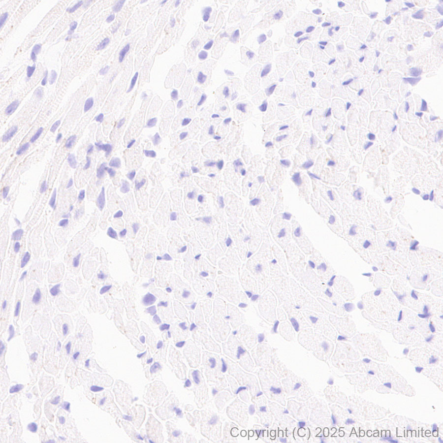 Immunohistochemistry (Formalin/PFA-fixed paraffin-embedded sections) - Anti-CD5L/CT-2 antibody [EPR29364-21] (AB324193), expandable thumbnail
