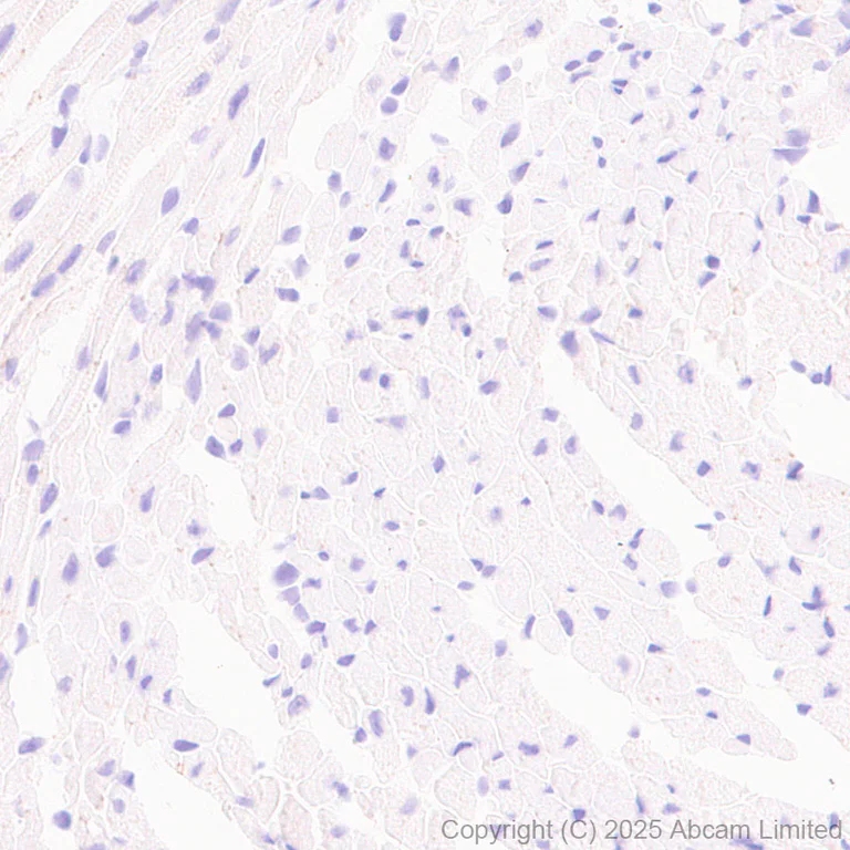 Immunohistochemistry (Formalin/PFA-fixed paraffin-embedded sections) - Anti-CD5L/CT-2 antibody [EPR29364-21] (AB324193)