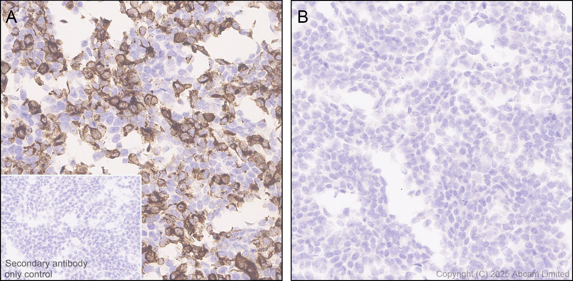 Immunohistochemistry (Formalin/PFA-fixed paraffin-embedded sections) - Anti-CD5L/CT-2 antibody [EPR29364-21] (AB324193), expandable thumbnail