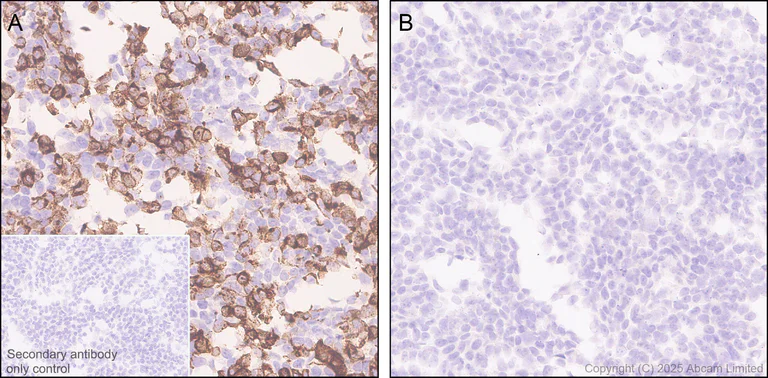 Immunohistochemistry (Formalin/PFA-fixed paraffin-embedded sections) - Anti-CD5L/CT-2 antibody [EPR29364-21] (AB324193)