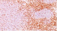 Immunohistochemistry (Formalin/PFA-fixed paraffin-embedded sections) - Anti-CD6/T12 antibody [3F7B5] (AB193341)
