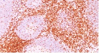 Immunohistochemistry (Formalin/PFA-fixed paraffin-embedded sections) - Anti-CD6/T12 antibody [3F7B5] (AB193341)