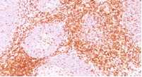 Immunohistochemistry (Formalin/PFA-fixed paraffin-embedded sections) - Anti-CD6/T12 antibody [3F7B5] (AB193341)