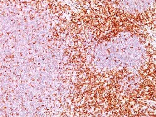 Immunohistochemistry (Formalin/PFA-fixed paraffin-embedded sections) - Anti-CD6/T12 antibody [3F7B5] - BSA and Azide free (AB213007), expandable thumbnail
