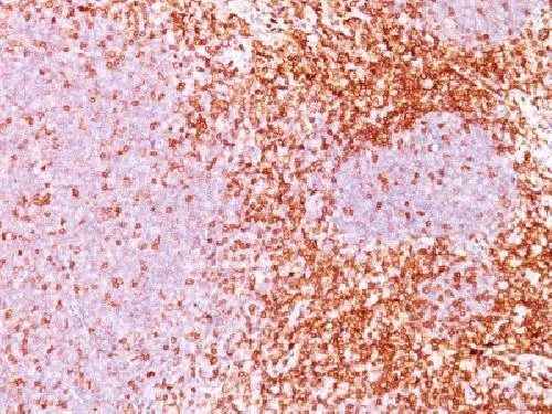 Immunohistochemistry (Formalin/PFA-fixed paraffin-embedded sections) - Anti-CD6/T12 antibody [3F7B5] - BSA and Azide free (AB213007)