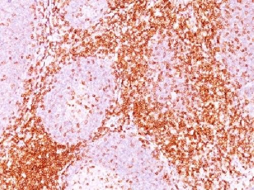 Immunohistochemistry (Formalin/PFA-fixed paraffin-embedded sections) - Anti-CD6/T12 antibody [3F7B5] - BSA and Azide free (AB213007), expandable thumbnail