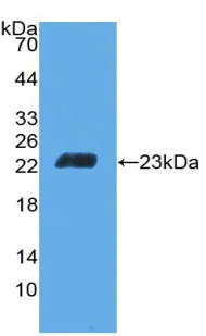 Western blot - Anti-CD6/T12 antibody (AB231314)