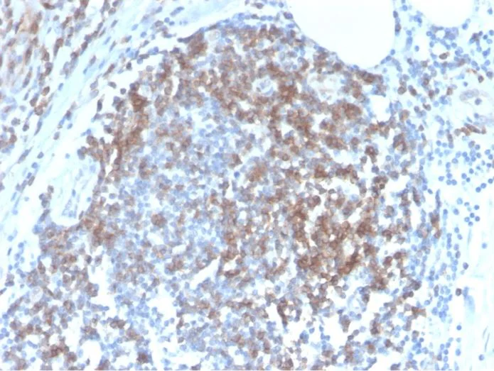 Immunohistochemistry (Formalin/PFA-fixed paraffin-embedded sections) - Anti-CD6/T12 antibody [C6/2884R] (AB270271)