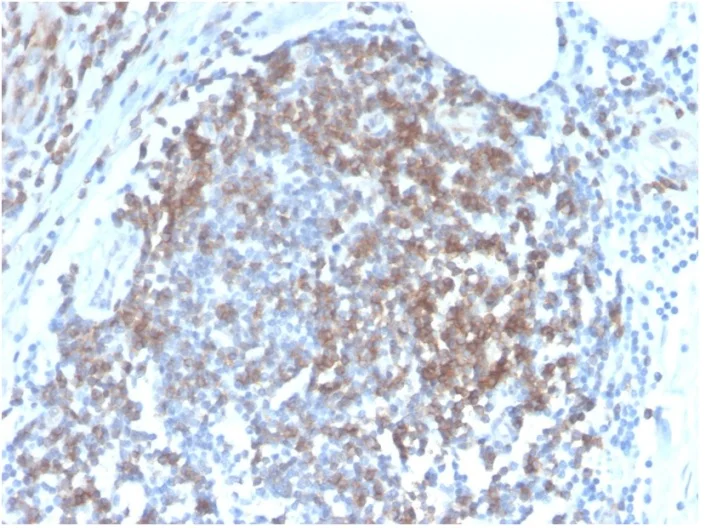 Immunohistochemistry (Formalin/PFA-fixed paraffin-embedded sections) - Anti-CD6/T12 antibody [C6/2884R] - BSA and Azide free (AB270302)