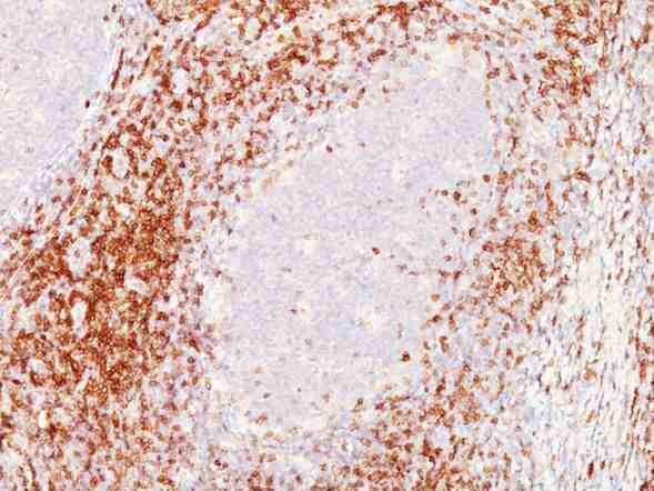 Immunohistochemistry (Formalin/PFA-fixed paraffin-embedded sections) - Anti-CD6/T12 antibody [C6/372 + 3F7B5] (AB199008)