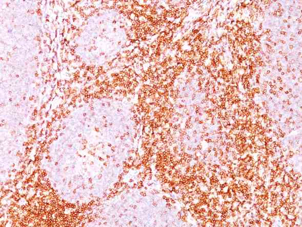 Immunohistochemistry (Formalin/PFA-fixed paraffin-embedded sections) - Anti-CD6/T12 antibody [C6/372 + 3F7B5] (AB199008)